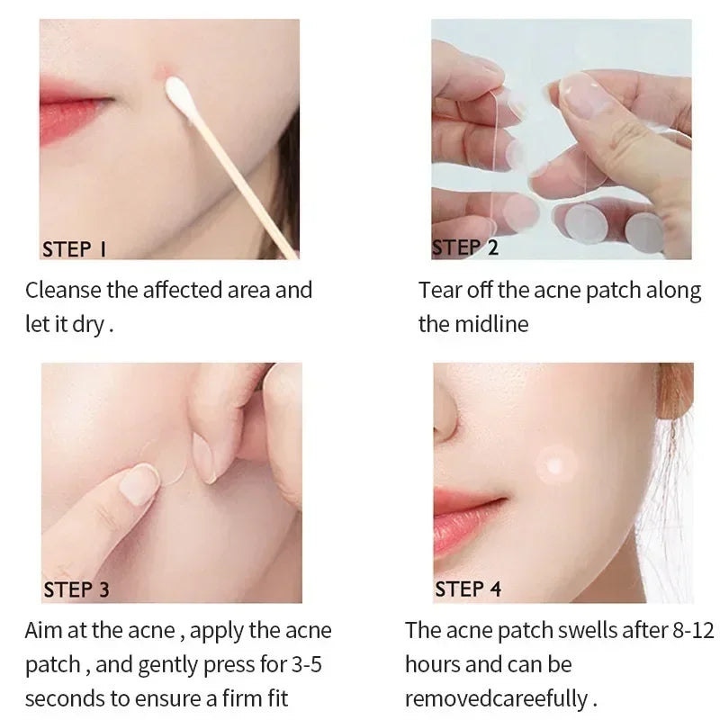 Invisible Hydrocolloid Acne Patches