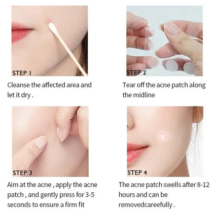 Invisible Hydrocolloid Acne Patches